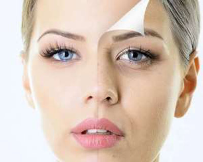 Laser Skin Rejuvenation